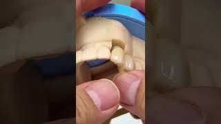 One implant dentist satisfying [upl. by Ettegroeg]