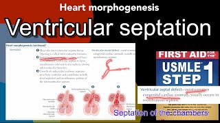 Septation of chambers  ventricular septation  Ventricular septal defect in HindiUrdu by first aid [upl. by Goldie890]