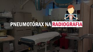 PNEUMOTÓRAX NA RADIOGRAFIA  Como identificar Dicas rápidas 1 [upl. by Naiviv]