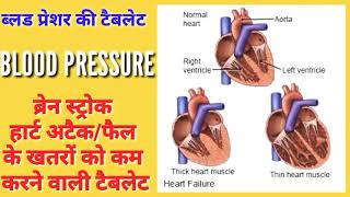 Envas 5mg tablet। Enalapril 5mg tablet। Blood pressure। Heart attack। Stroke। Heart failure। details [upl. by Adniram]