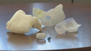 How 3D printers help aide medical teams in complex procedures [upl. by Bettzel385]