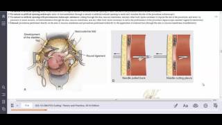 HIT 208 PortaCath Removal External vs Open Approach Explained [upl. by Karine786]