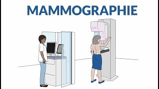 Comment se passe une mammographie [upl. by Gilleod]