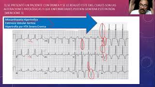 Respuesta a Examen de Electrocardiograma [upl. by Siroval570]