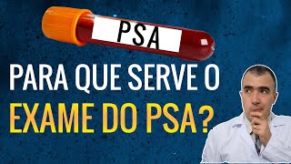 Para que serve o EXAME DO PSA [upl. by Roel132]