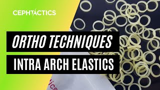 Intra Arch Elastics in Orthodontics [upl. by Gloria923]