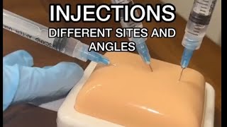 injections different sites and angles  injection doctor medical medicine [upl. by Abram480]