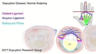 Dupuytren disease anatomy [upl. by Mccready]