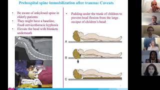 Medical Student Lecture Series  Spine Trauma [upl. by Atekahs]