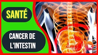 17 Symptômes du CANCER DE LINTESTIN [upl. by Pulchi]