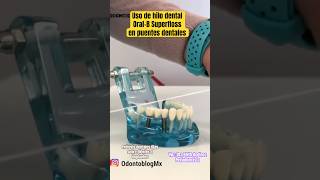 Uso de hilo Superfloss en puentes dentales superfloss hilodental protesisdental puentedental [upl. by Nilrak]