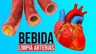 3 Ingredientes se viralizan al ser capaces de limpiar las arterias coronarias [upl. by Naihtsirc133]