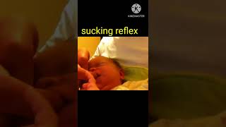 newborn reflexes pediatricnursing reflexesshortsfeedshortsshortsvideofeedshorts [upl. by Misty884]