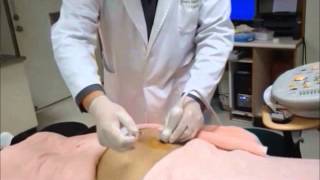 UltrasoundGuided Sacroiliac Joint Injection Technique [upl. by Llertnov]