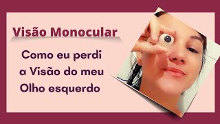 Visão Monocular  Como eu perdi a visão do meu olho esquerdo [upl. by Lenee]