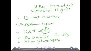 QUICK PEDIATRICS Criteria to diagnose ABO incompatibility [upl. by Kylynn]