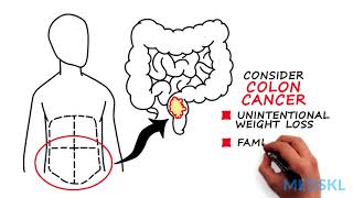 Abdominal and Pelvic Masses What location can tell you about a mass [upl. by Akiwak]