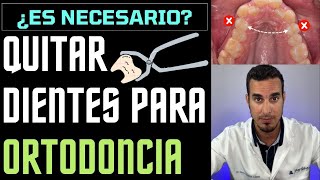 EXTRAER DIENTES para una ORTODONCIA  ¿Te han dicho de QUITAR los PREMOLARES ¿Es necesario [upl. by Sherr149]