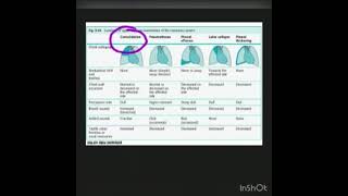 Respiratory System Examination Findings Made Easy [upl. by Osrick]