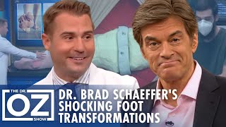 The Most Shocking Foot Transformations with Dr Brad Schaeffer  Oz Health [upl. by Garth]