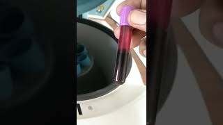 Centrifuge machine plasma separation of blood [upl. by Micheline]