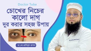 চোখের নিচের কালো দাগ দূর করার উপায়  Bangla Tips Remove dark spots  Choker Kalo Dag Dur Kora upay [upl. by Tavi162]