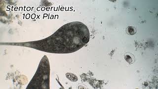 Stentor city  Stentor coeruleus under microscope [upl. by Orsola]