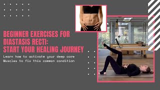 Beginner Exercises for Diastasis Recti Strengthen Your Deep Core [upl. by Friede]