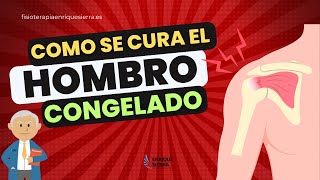 ¿CÓMO SE CURA UN HOMBRO CONGELADO ✅ QUÉ ES SÍNTOMAS CAUSAS EJERCICIOS Y TRATAMIENTO [upl. by Schecter]