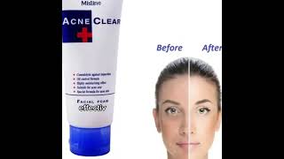 Mistine acne clear face wash facial foam [upl. by Amrak]