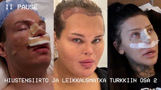 HIUSTENSIIRTO JA LEIKKAUSMATKA TURKKIIN OSA 2  Henny Harjusola [upl. by Jairia349]