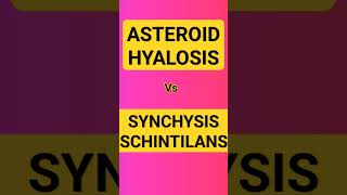 ASTEROID HYALOSIS vs SYNCHYSIS SCHINTILANS [upl. by Evan]