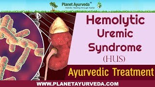 Ayurvedic Treatment of Hemolytic Uremic Syndrome HUS [upl. by Flieger79]