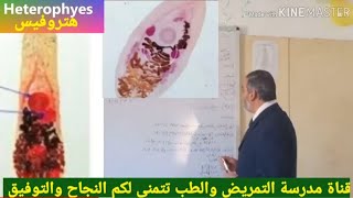 ديدان الهتروفيس Heterophyes [upl. by Maressa]