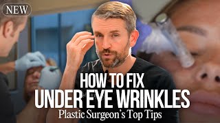 What To Do About Your Under Eye Wrinkles [upl. by Rufina]