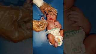 Suction process dr remove bad wayer from stomach and cleaned it carefully newborn baby [upl. by Deery]