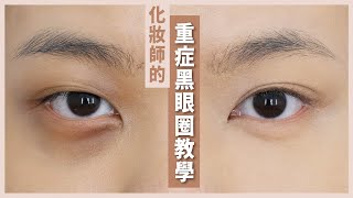 🍄嚴重重症黑眼圈教學🍄 👁️👁️ 專業化妝師秘技 [upl. by Claudette]