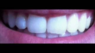 Blend a med Whitestrips [upl. by Nrevel]