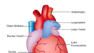 Herzinfarkt Myokardinfarkt Herzschlag [upl. by Ana]