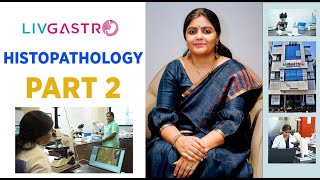 DISCUSSION ON HISTOPATHOLOGY PART 2  SYMPTOMS  TREATMENT  LIFESTYLE  DRANSHITA RAI [upl. by Howund]