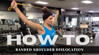 Banded Shoulder Dislocation [upl. by Buddy]