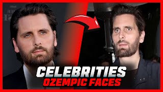 Ozempic Face Has Taken Over Hollywood  Celebrity Secrets REVEALED [upl. by Sennahoj841]