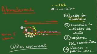 Degenerações Parte 1 Acúmulos Intracelulares  Resumo  Patologia [upl. by Atteloc]