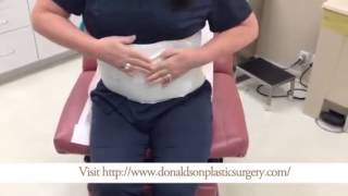 How To Place an Abdominal Binder After Tummy Tuck Surgery [upl. by Richter]