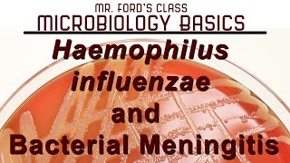 Haemophilus influenzae and Bacterial Meningitis  Microbiology Lectures [upl. by Nnylhtak]