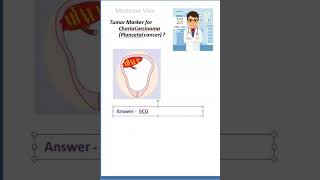 Medicine Tumor Marker for ChorioCarcinoma Placenta hCG [upl. by Ab407]
