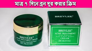 ব্রন দূর করার ক্রিম  ছেলেমেয়ে সবার ব্রন কমাবে Breylee acne Treatment cream [upl. by Eciruam]