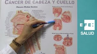 Cáncer en la boca por infecciones tabaco y alcohol [upl. by Kathy]