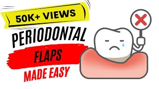 Periodontal flap part 1 [upl. by Akihc574]