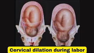 Cervical dilation how to check for laborhow to check if your cervix is dilated [upl. by Sivehc]